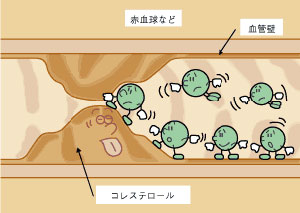 イラストトレス01